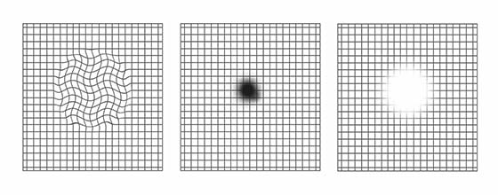 Amsler grid