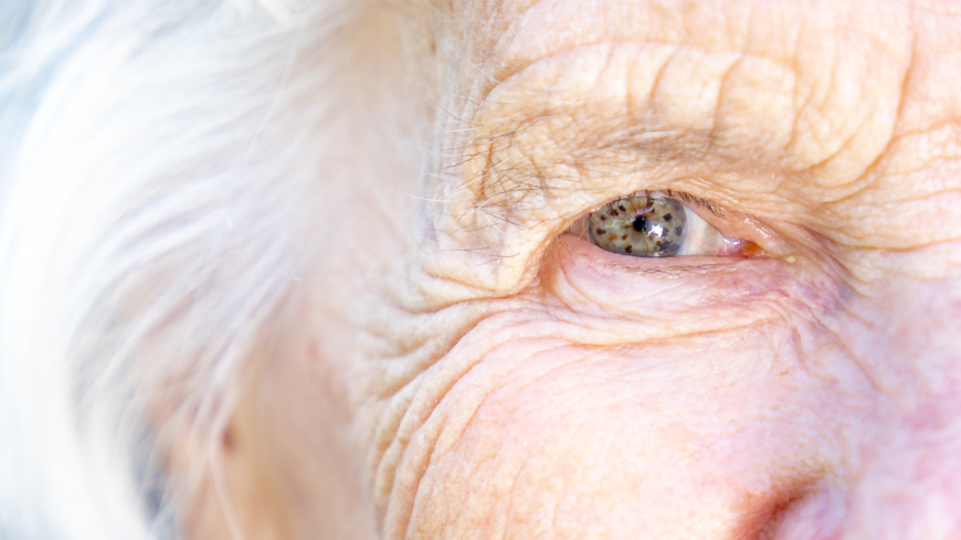 Med stigande ålder förändras våra ögon och vår syn. Synpåverkan och torrhetskänsla blir vanligare. Foto: Shutterstock