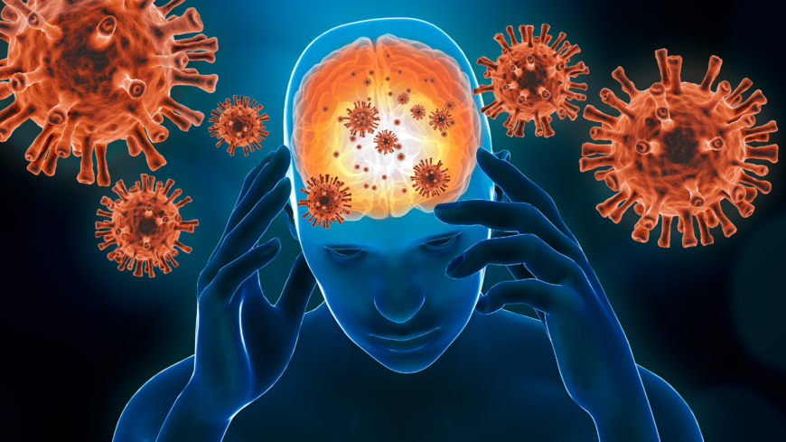 Hjärninflammation orsakas av virus i hjärnvävnaden. Foto: Getty Images