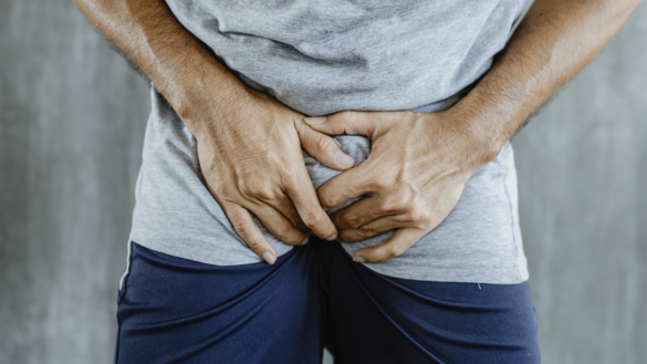 Testikelvridning (torsio testis)