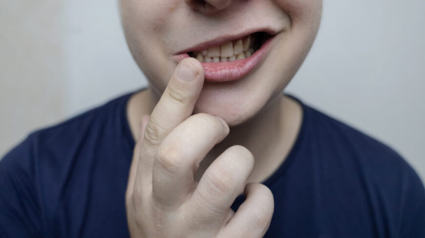 Ansiktsförlamning: symtom, orsak & behandling