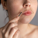 Ökad hårväxt hos kvinnor (hirsutism)