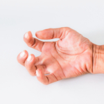 Spasticitet efter stroke: orsak, symtom & behandling