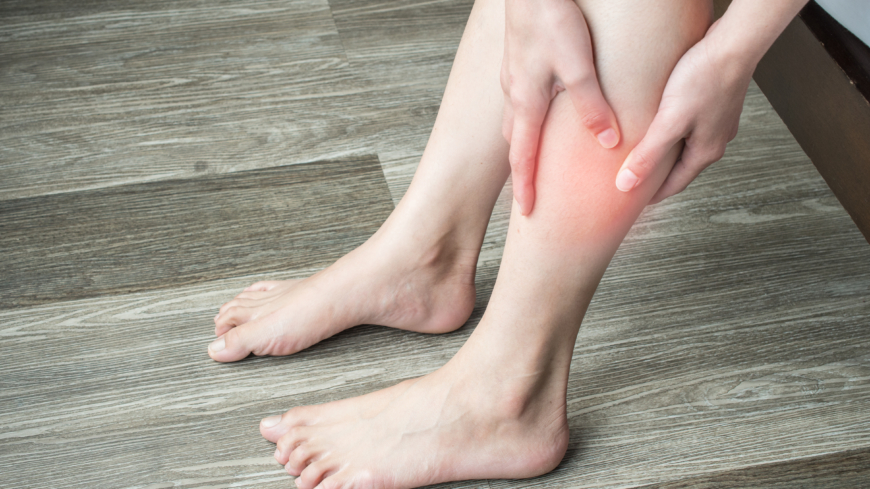 Blodproppar är vanligast i benen och börjar ofta i ett blodkärl i ena vaden. Smärta, ömhet och svullnad är exempel på typiska symtom. Foto: Shutterstock