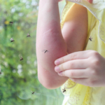 Tips för att undvika insektsbett