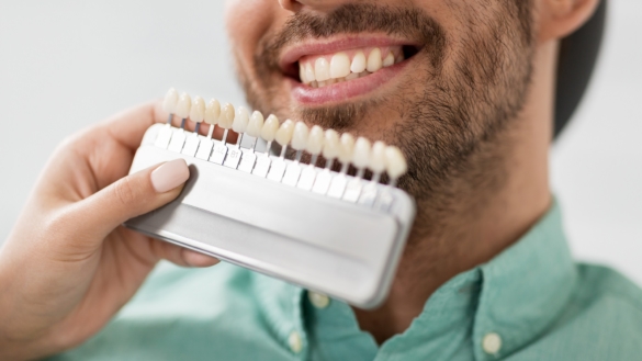 Missfärgad tand – vad kan du göra åt det?