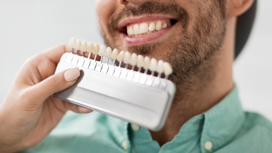 Det brukar gå att behandla missfärgande tänder på ett bra sätt. Foto: Shutterstock