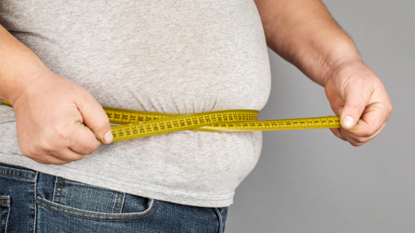 Diabeteskirurgi effektivt vid diabetes typ 2