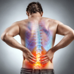 Axial spondylartrit (AxSpa): orsak, symtom & behandling
