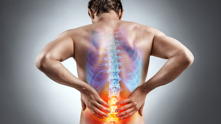 Axial spondylartrit drabbar rygg och bäcken, och ger stelhet och smärta. Foto: Shutterstock