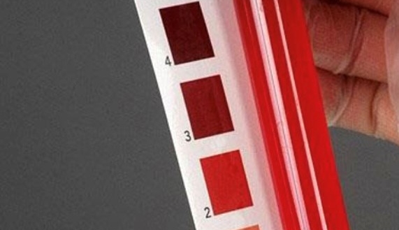 Urinblåsecancer – den ”bortglömda” cancersjukdomen