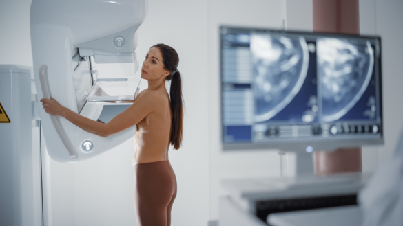 Ojämlik screening för upptäckt av bröstcancer
