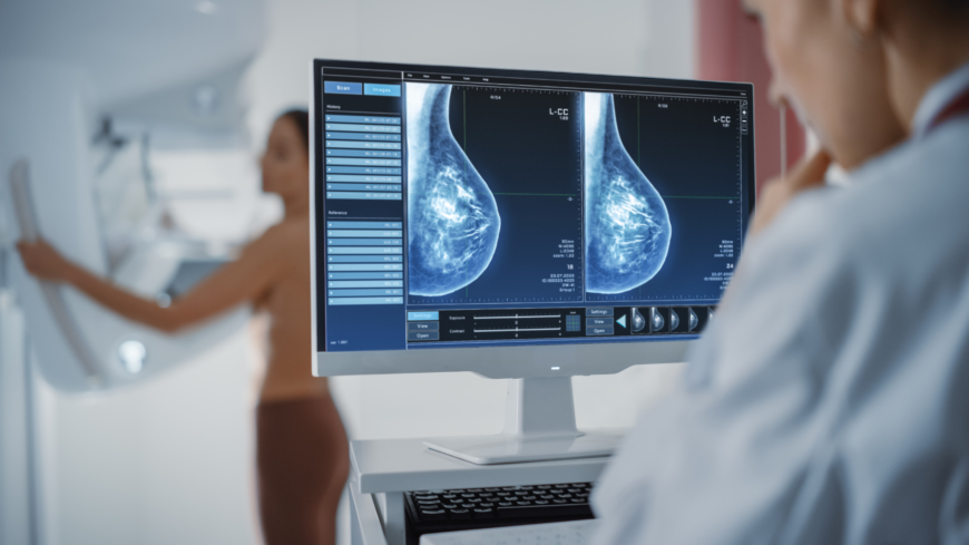 Med dagens rekommendationer erbjuds kvinnor i åldern 40–74 år  screening med mammografi med 18 till 24 månaders intervall. Foto: Shutterstock