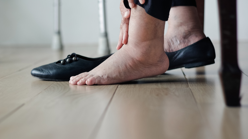  Tre av tio läsare på Doktorn.com anger att svullnad i fötter gör det svårt att hitta skor som passar. Foto: GettyImages