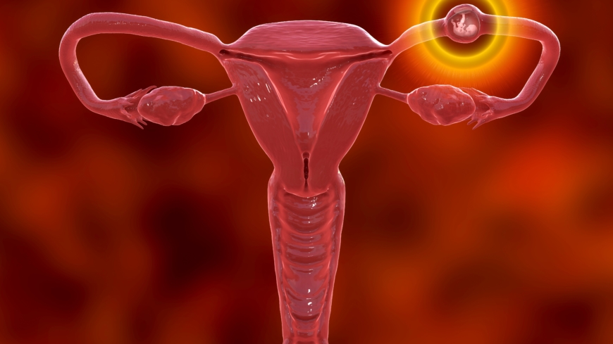 De flesta extrauterina graviditeter, även kallade utomkvedshavandeskap, sitter i äggledaren Foto: Shutterstock