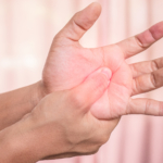 CRPS – komplext regionalt smärtsyndrom