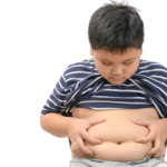 PCOS ökar risken för obesitas hos söner