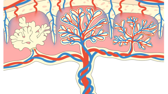 Mola/Druvbörd: orsak, symtom & behandling