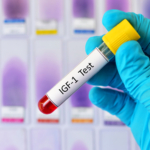 Akromegali (godartad tumör i hypofysen): orsak, symtom & behandling