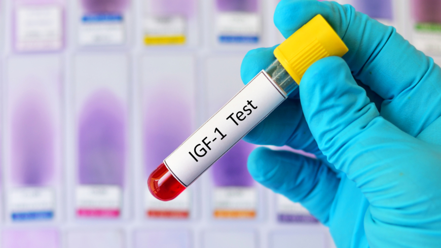 Vid misstanke om akromegali tar man blodprover för att mäta IGF-I. Foto: Getty Images