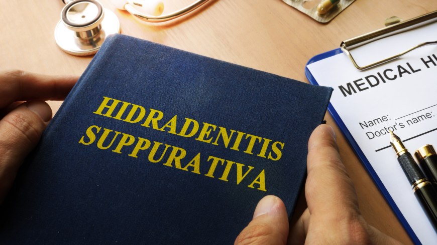 Hidradenitis suppurativa (HS) kan ge symtom som bölder, knölar och fistlar i huden. Foto: Getty Images