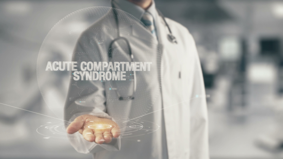 Kompartmentsyndrom: orsak, symtom & behandling