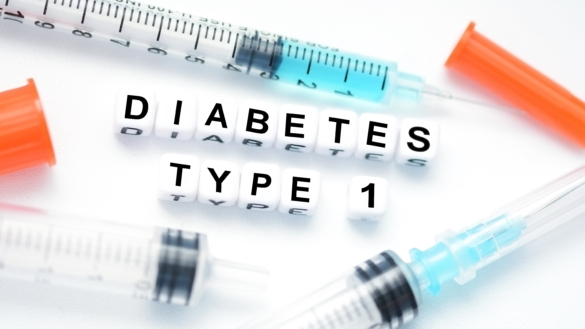 Ketoacidos: akut komplikation vid diabetes