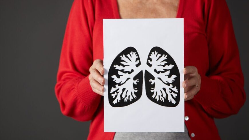 Första Lungfibrosrapporten avslöjar omfattande brister i vården för tusentals drabbade patienter. Foto: Getty Images