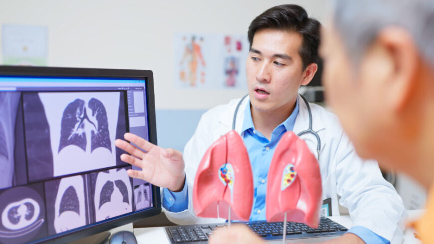 Lungcancer ökar bland icke-rökare