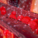 Takayasus arterit – orsak, symtom & behandling