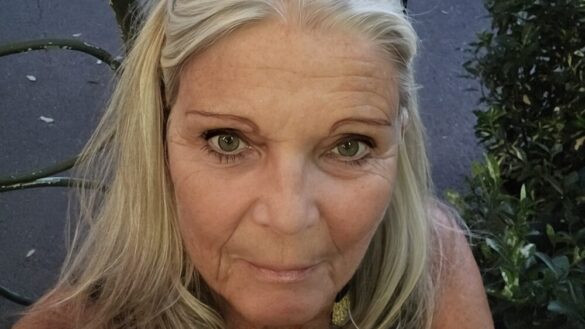 Reumatoid artrit (RA) – en sjukdom som förändrar livet