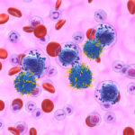 Kronisk lymfatisk leukemi (KLL) – symtom, orsak och behandling