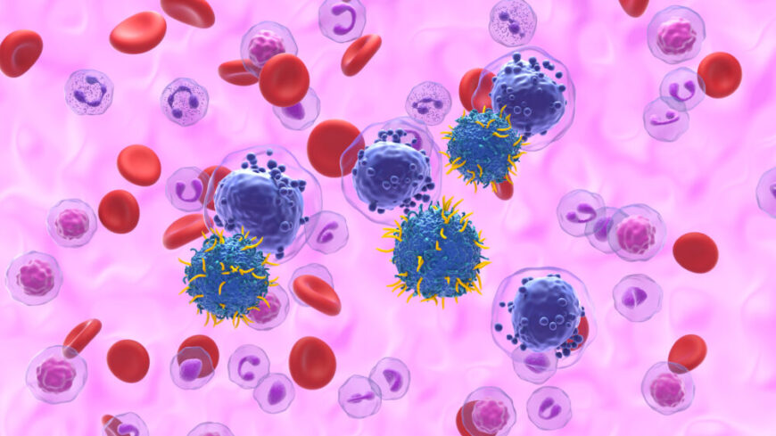 KLL är en sjukdom i vissa vita blodkroppar som kallas B‑lymfocyter, en del av kroppens immunförsvar som ska skydda mot infektioner. Foto: Getty Images