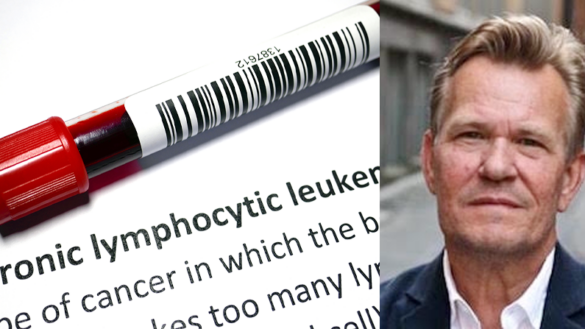 ”Jag fick veta att jag hade leukemi – och att jag inte behövde behandling”