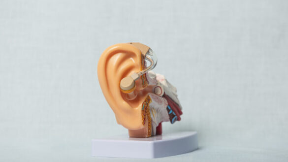 Otoskleros – orsak, symtom & behandling