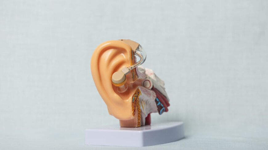 Otoskleros påverkar stigbygeln och kan orsaka hörselnedsättning. Foto: Getty Images