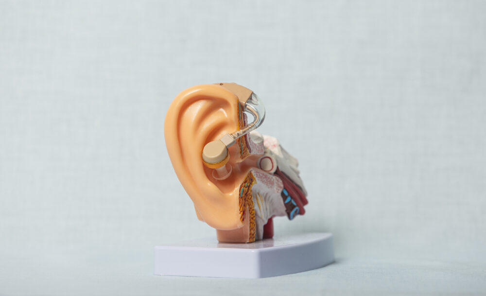 Otoskleros – orsak, symtom & behandling