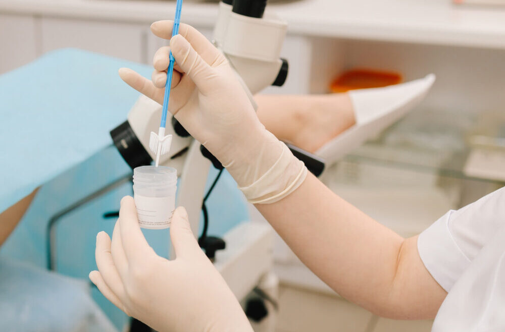 Cellprov och HPV-test – så förebyggs livmoderhalscancer