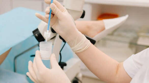 Cellprov och HPV-test – så förebyggs livmoderhalscancer