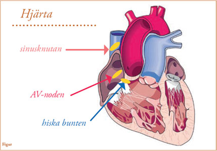 Ablation förändrade livet för Stefan Holmsten