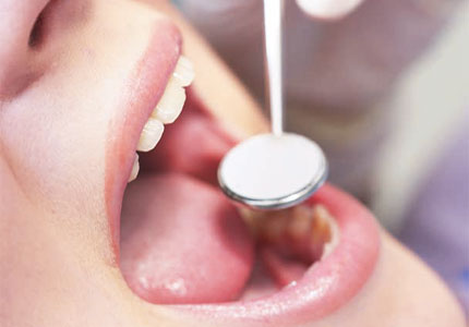Billiga alternativ hos tandläkaren blir vanligare