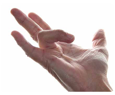 Nytt läkemedel mot ”vikingasjukan”