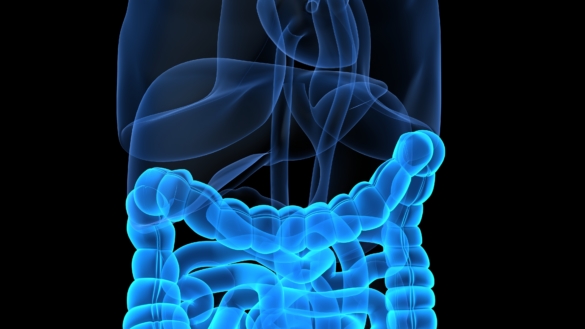 Tarmens immunförsvar orsak till sjukdom?