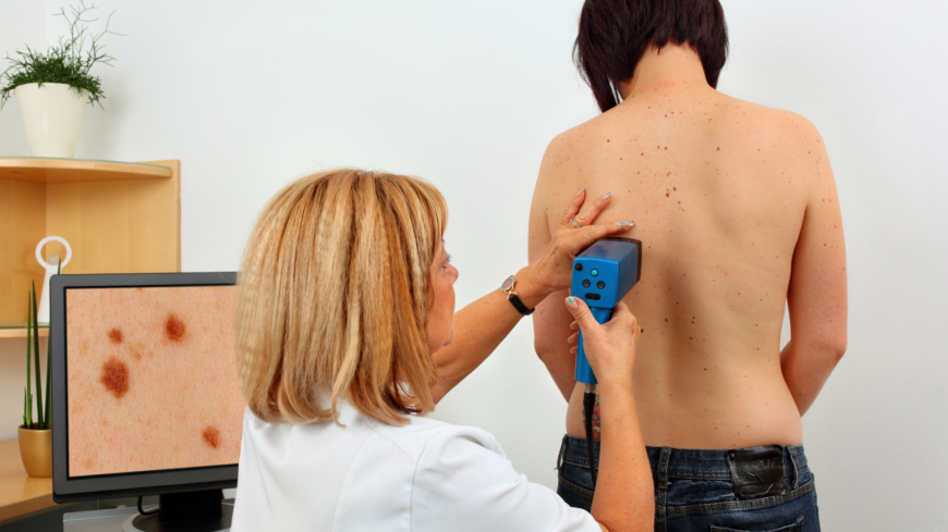 Ett foto till specialistmottagning skulle kunna snabba på diagnostiseringen av hudcancer konstaterar Statens beredning för medicinsk utvärdering. Foto: Shutterstock