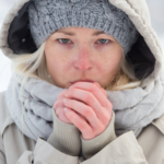 Köldallergi: orsak, symtom & behandling