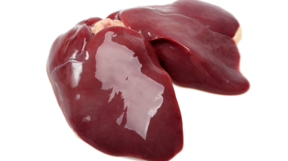 Levercancer (Hepatocellulär cancer)