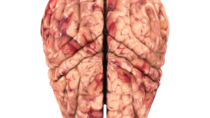 Hjärninflammation orsakas av virus i hjärnvävnaden. Foto: Shutterstock