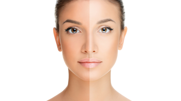 Borderlinepersonlighet (EIPS): orsak, symtom & behandling