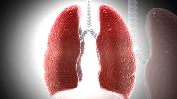 Sarkoidos (Schaumanns sjukdom): orsak, symtom & behandling