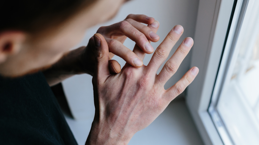 Irritationseksem uppkommer när du har händerna mycket i vatten. Händerna blir torra och nariga och eksem utvecklas. Foto: Shutterstock